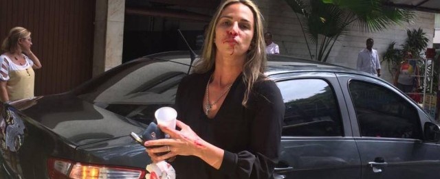 Jogadora de vôlei diz ter sido espancada por taxista no Rio