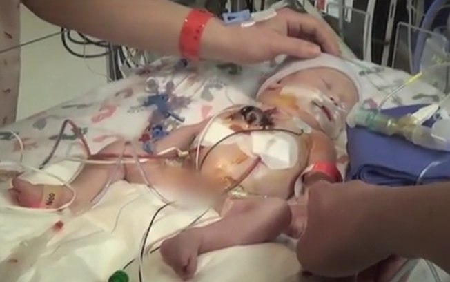 Kieran precisou ser levada rapidamente para cirurgia (Crédito: Daily Mail)