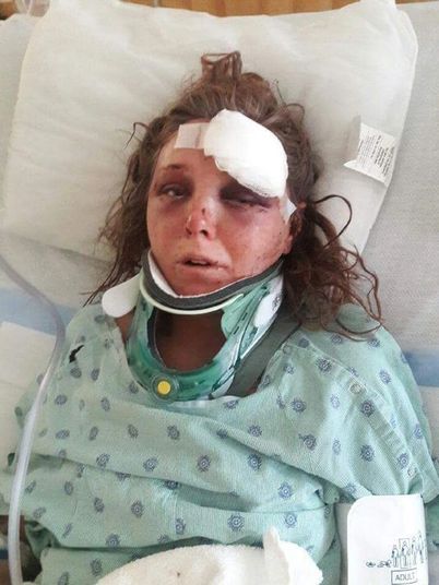 "Ele arrrancou a minha língua", diz mulher agredida pelo namorado