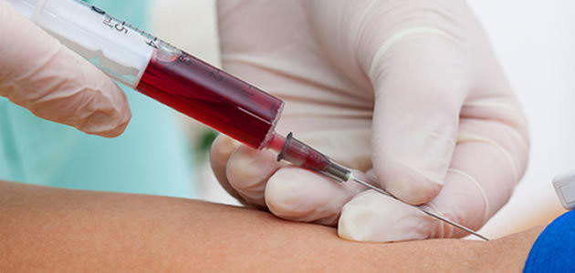 Câncer pode ser identificado por exame de sangue