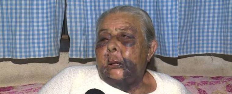 Cuidador é suspeito de estuprar e espancar idosa de 75 anos