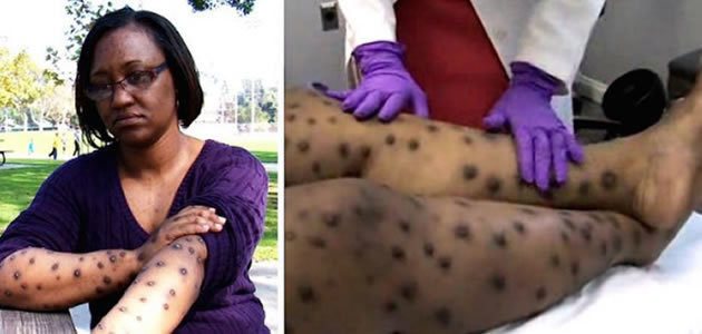 Mulher passa uma década com doença horrível