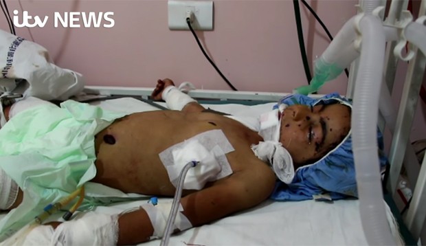 Menina chegou a ser levada para hospital de Aleppo, mas não resistiu (Crédito: Reprodução)