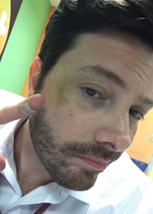 Danilo Gentili se machuca durante filmagem de filma