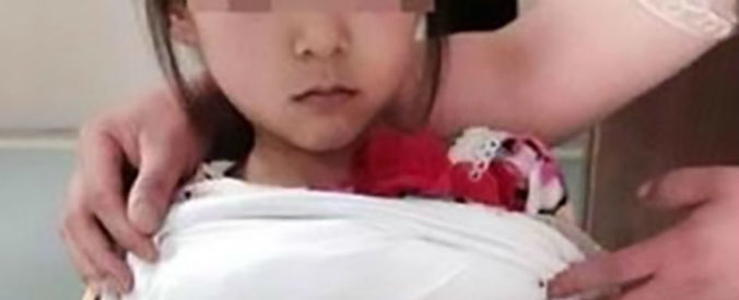 Aos 12 anos, grávida vai ao hospital e o "marido", de 40, é preso