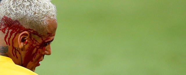 Brasil goleia Bolívia com show de Neymar que sai sangrando do jogo