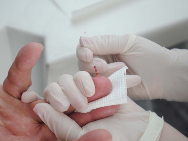 Teste de HIV é realizado de forma rápida, e resultado sai em 20 minutos (Crédito: Reprodução)