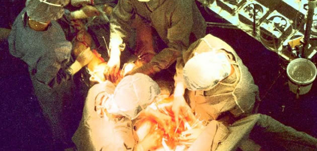 9 coisas que você precisa saber sobre o transplante