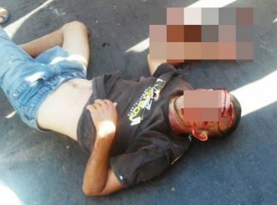 Acidente na BR 343 deixa homem gravemente ferido em Campo Maior