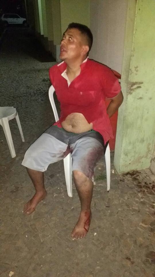 Homem tenta roubar arma de vigilante e é alvejado