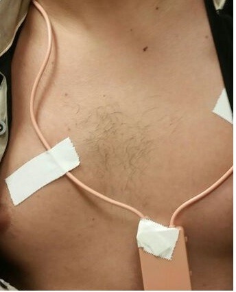 Candidato de 34 anos é preso em flagrante por usar ponto eletrônico (Crédito: Divulgação/ PF)