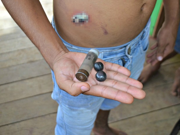 Menino de 3 anos é atingido por balas de borracha no Acre