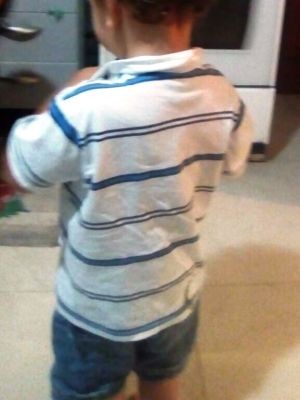 Garoto foi agredido em creche (Crédito: Arquivo Pessoal)