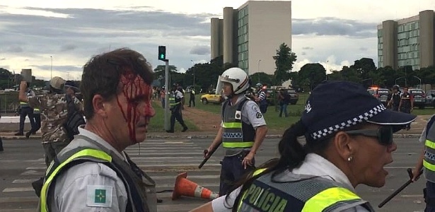 Policial militar do Distrito Federal ficou ferido durante confronto (Crédito: UOL)