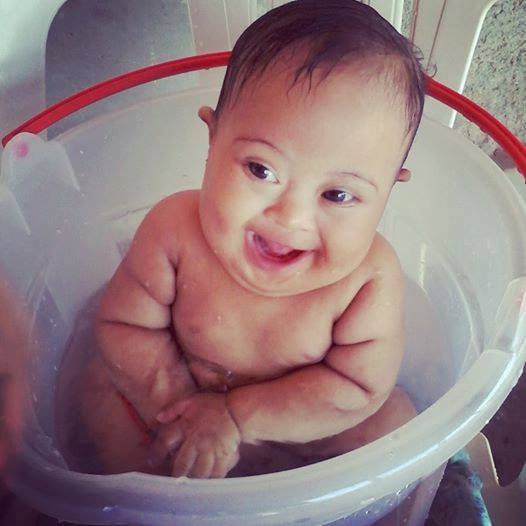 Bebê com cardiopatia congênita precisa de cirurgia urgente