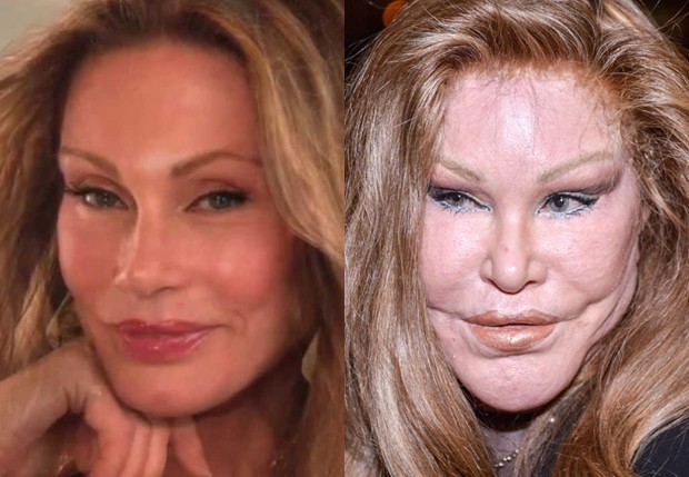 Jocelyn Wildenstein