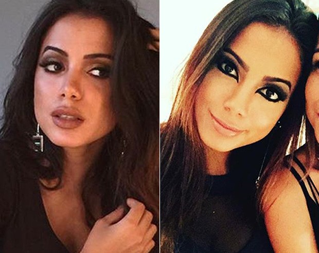 Anitta apareceu com os lábios mais grossos