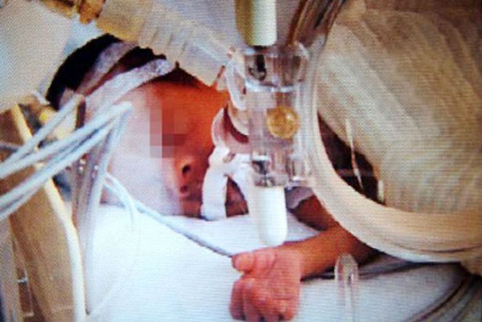 Bebê foi declarado morto, mas voltou a vida momentos antes de ser cremado (Crédito: Reprodução)
