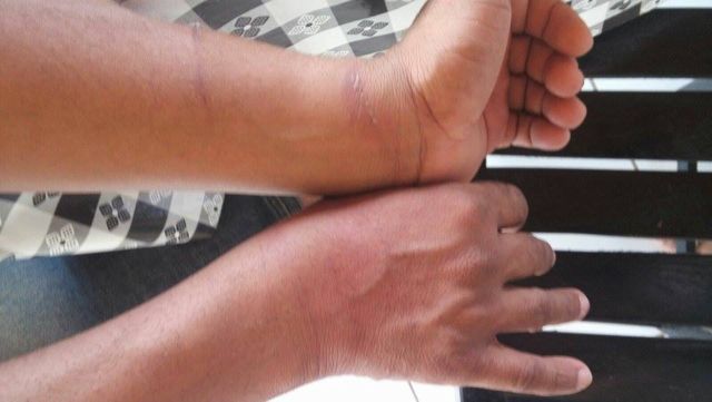 Vítimas mostram sinais de tortura (Crédito: Divulgação)