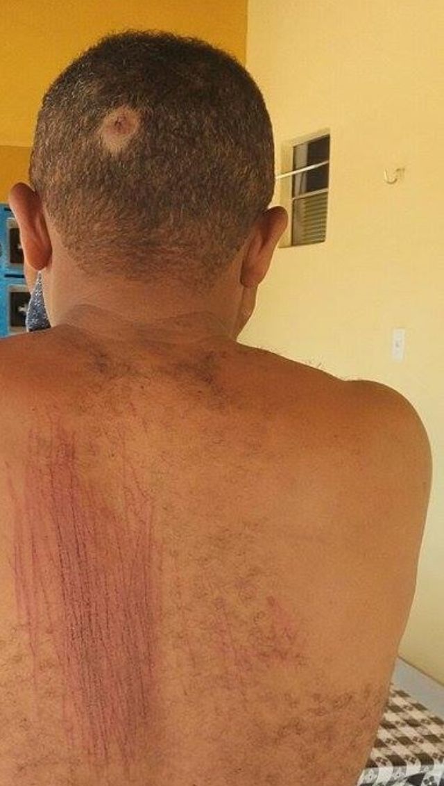 Vítimas mostram sinais de tortura (Crédito: Divulgação)