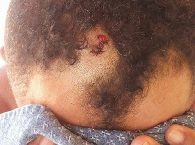 Vítimas mostram sinais de tortura (Crédito: Divulgação)