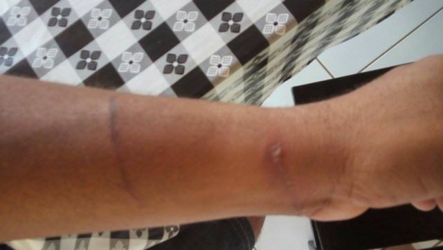 Vítimas mostram sinais de tortura (Crédito: Divulgação)
