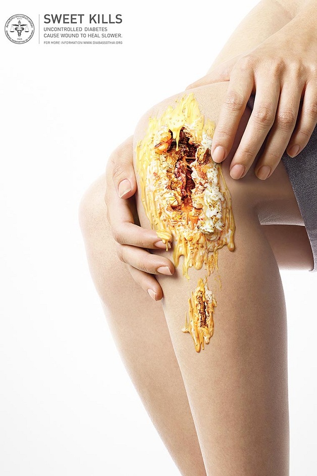 Anúncio criativo sobre diabetes (Crédito: Divulgação)