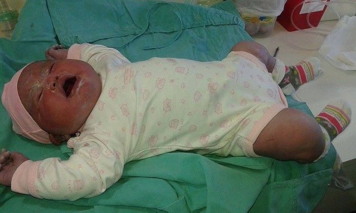Bebê impressionou médicos (Crédito: Reprodução)