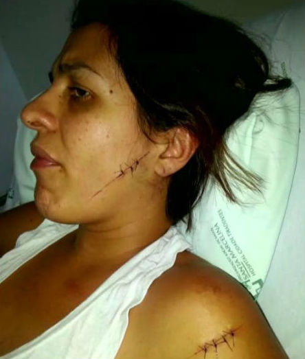 Raquel foi atingida com 11 facadas (Crédito: Reprodução)