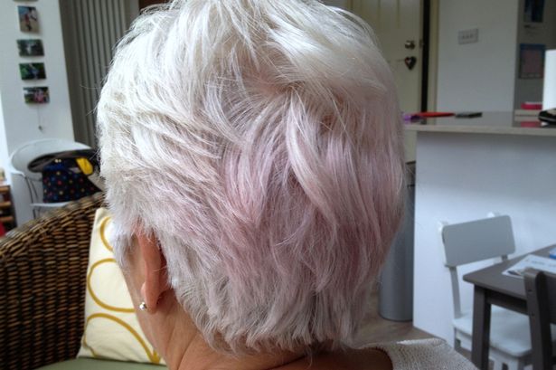 Mulher acordou com outra cor no cabelo