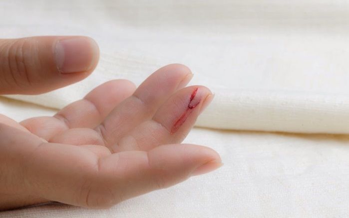 Corte nos dedos com folha de papel (Crédito: Divulgação)