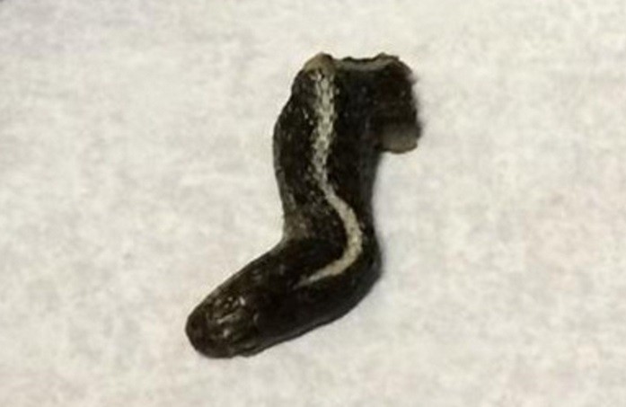 Americana encontra cabeça de cobra em lata de vagens (Crédito: Reprodução)