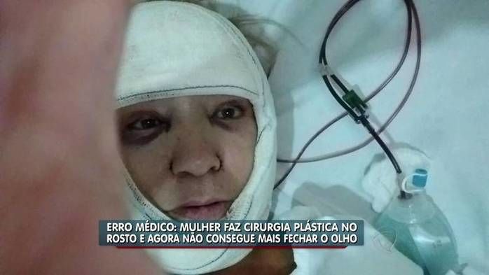 Mulher não consegue mais fechar o olho (Crédito: Reprodução)