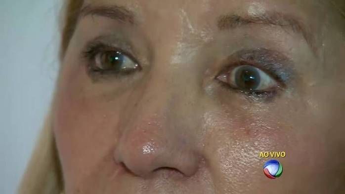 Mulher não consegue mais fechar o olho (Crédito: Reprodução)