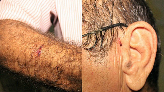 José Ribeiro, mais conhecido por "Zé Babão" foi agredido pelos assaltantes