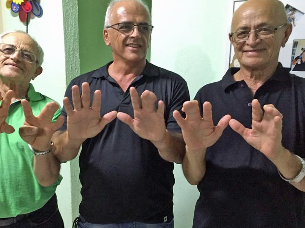 Família que tem 20 pessoas com dedos "colados" chama atenção na web (Crédito: Reprodução)