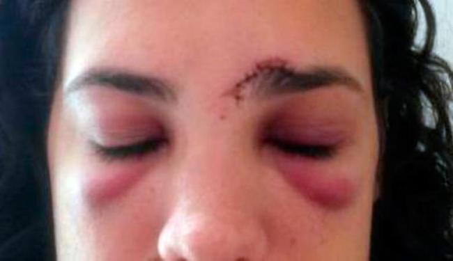 Mulher agredida (Crédito: Divulgação)