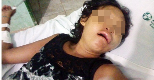 Mulher tem rosto desfigurado ao ser espancada pelo marido (Crédito: Reprodução)
