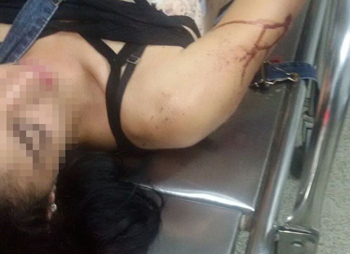 Jovem é atingida por tiro (Crédito: Divulgação)