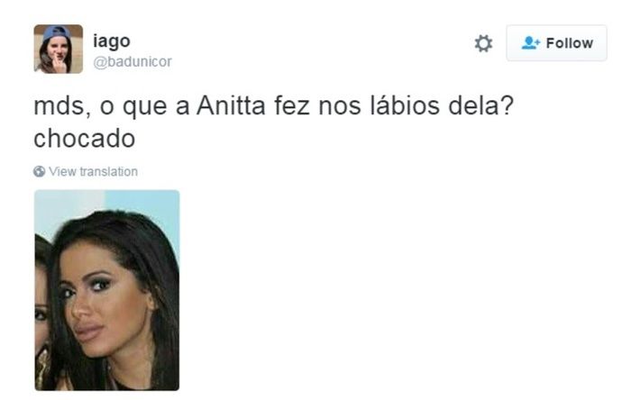 Boca de Anitta vira alvo de críticas nas redes sociais (Crédito: Reprodução)