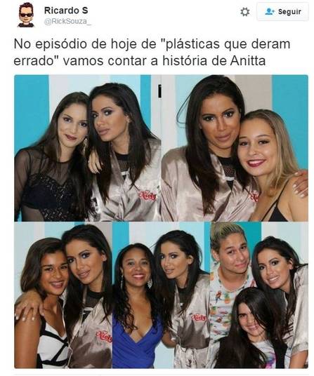 Boca de Anitta vira alvo de críticas nas redes sociais (Crédito: Reprodução)