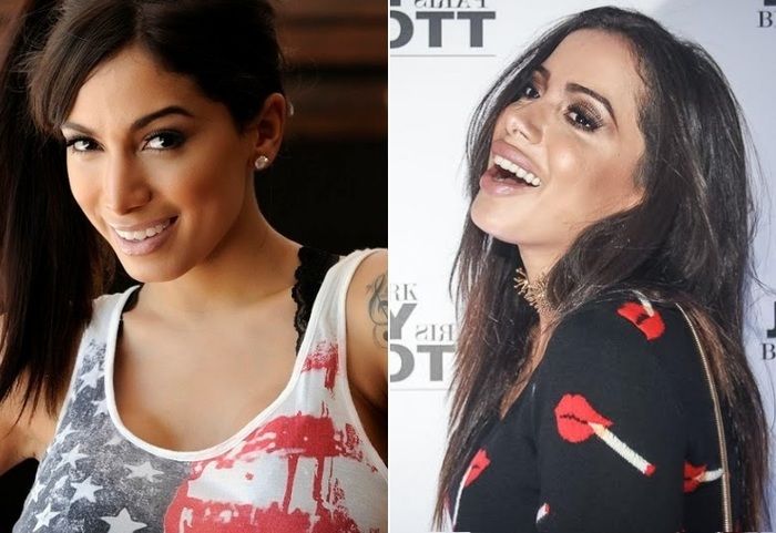 Boca de Anitta vira alvo de críticas nas redes sociais (Crédito: Reprodução)