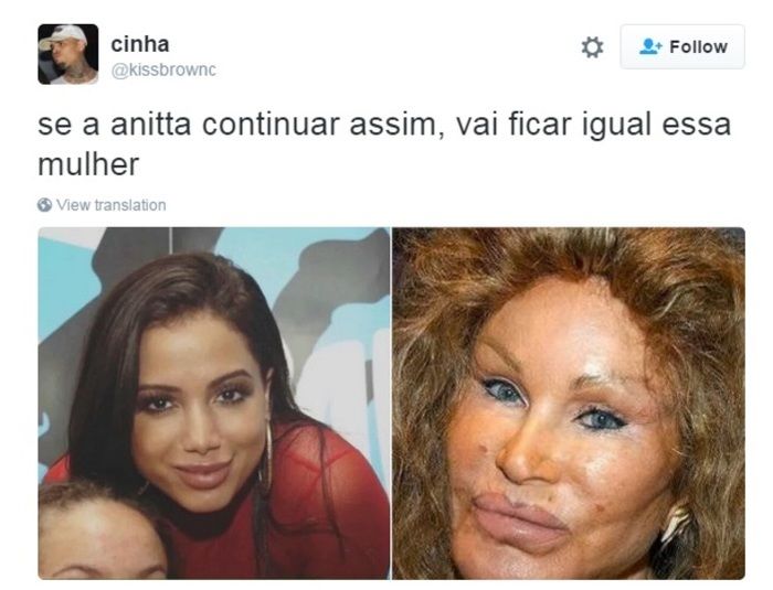 Boca de Anitta vira alvo de críticas nas redes sociais (Crédito: Reprodução)