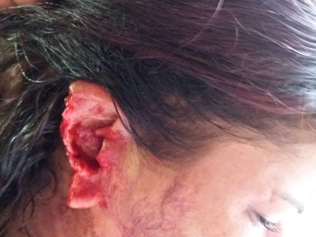 Mulher teve parte da orelha arrancada (Crédito: Divulgação/Polícia Civil))