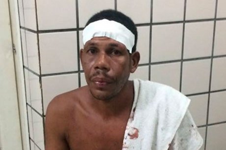 Agressor bebia em bar com outra mulher antes de agredir a companheira (Crédito: Reprodução)