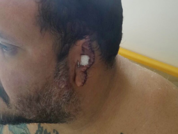 Homem tem parte da orelha arrancada em briga de trânsito em SP (Crédito: Reprodução)