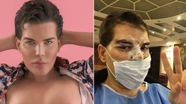 Rodrigo Alves, "Ken Humano" brasileiro (Crédito: Reprodução)