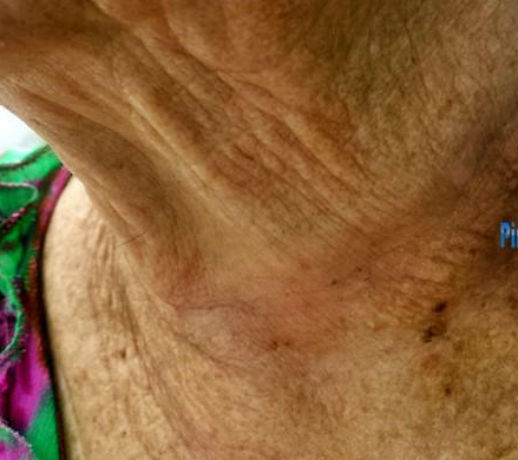 Idosa foi assaltada por homem que se passava por agente da Eletrobras