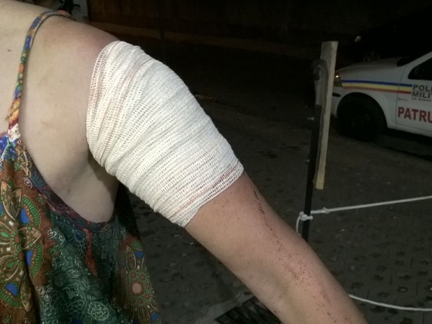 A vítima teve o braço atingido pelo flanelinha (Crédito: Divulgação)