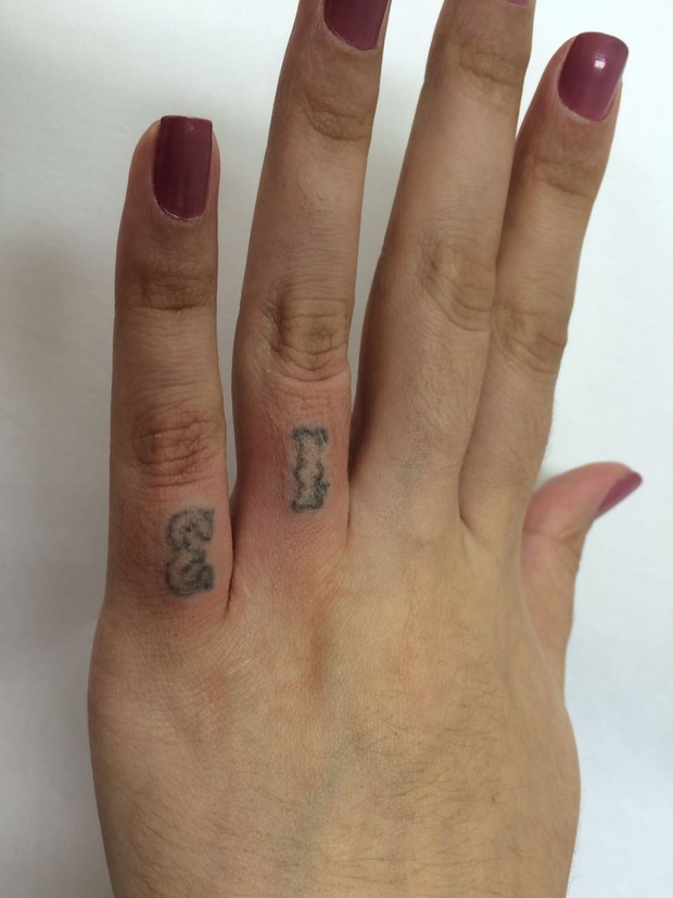 Andressa Urach remove tatuagens (Crédito: Divulgação)